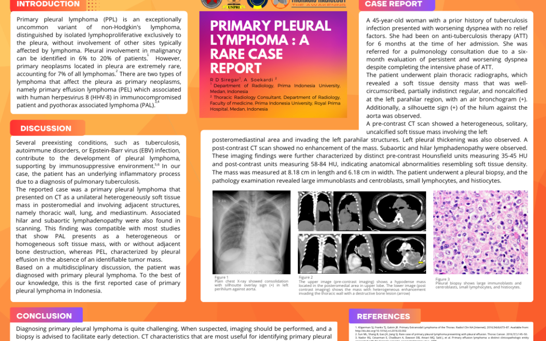 Primary Pleural Lymphoma : A Rare Case Report