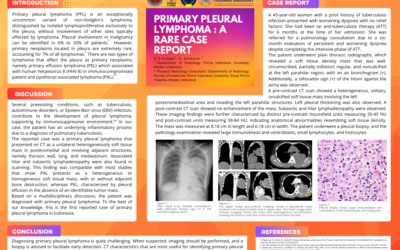Primary Pleural Lymphoma : A Rare Case Report