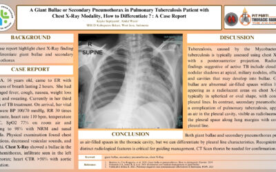 A Giant Bullae or Secondary Pneumothorax in Pulmonary Tuberculosis Patient with Chest X-Ray Modality, How to Differentiate? : A Case Report