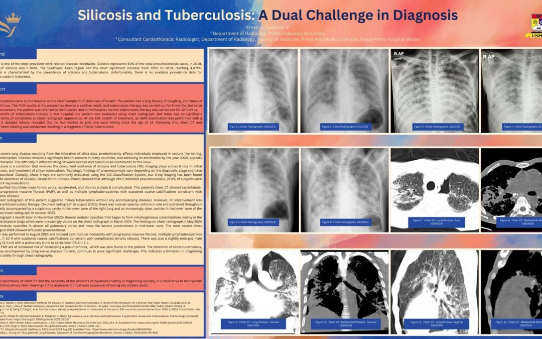 Silicosis and Tuberculosis: A Dual Challenge in Diagnosis