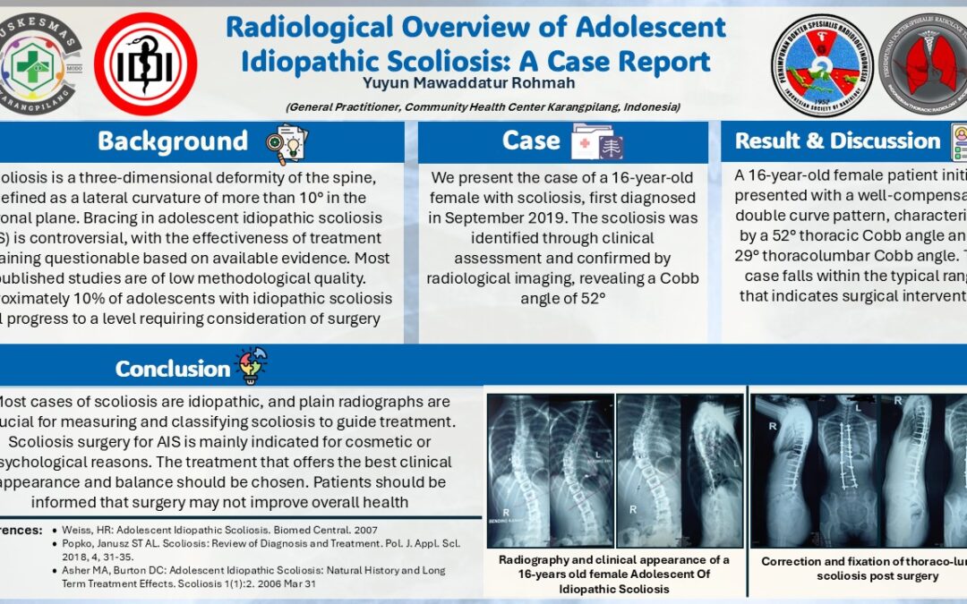 Radiological Overview of Adolescent Idiopathic Scoliosis: A Case Report