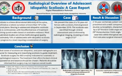Radiological Overview of Adolescent Idiopathic Scoliosis: A Case Report