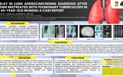 Delay in Lung Adenocarcinoma Diagnosis After Being Mistreated with Pulmonary Tuberculosis in A 45-Year-Old Woman: A Case Report