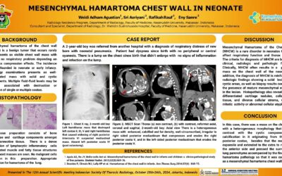 Mesenchymal Hamartoma Chest Wall in Neonate